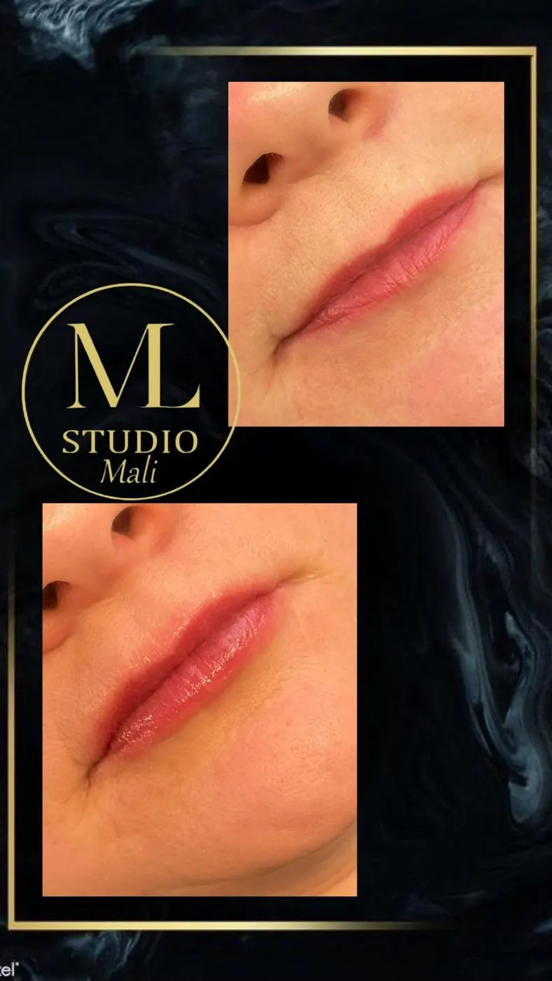 Professionelle Behandlung – Studio MaLi